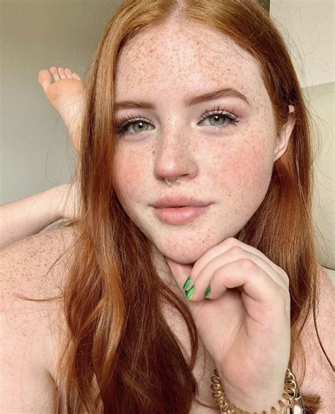 nude freckles|Fetish: Freckles